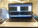 Computer Readings - Medical Devices